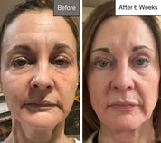 Omnilux Contour Face LED Mask