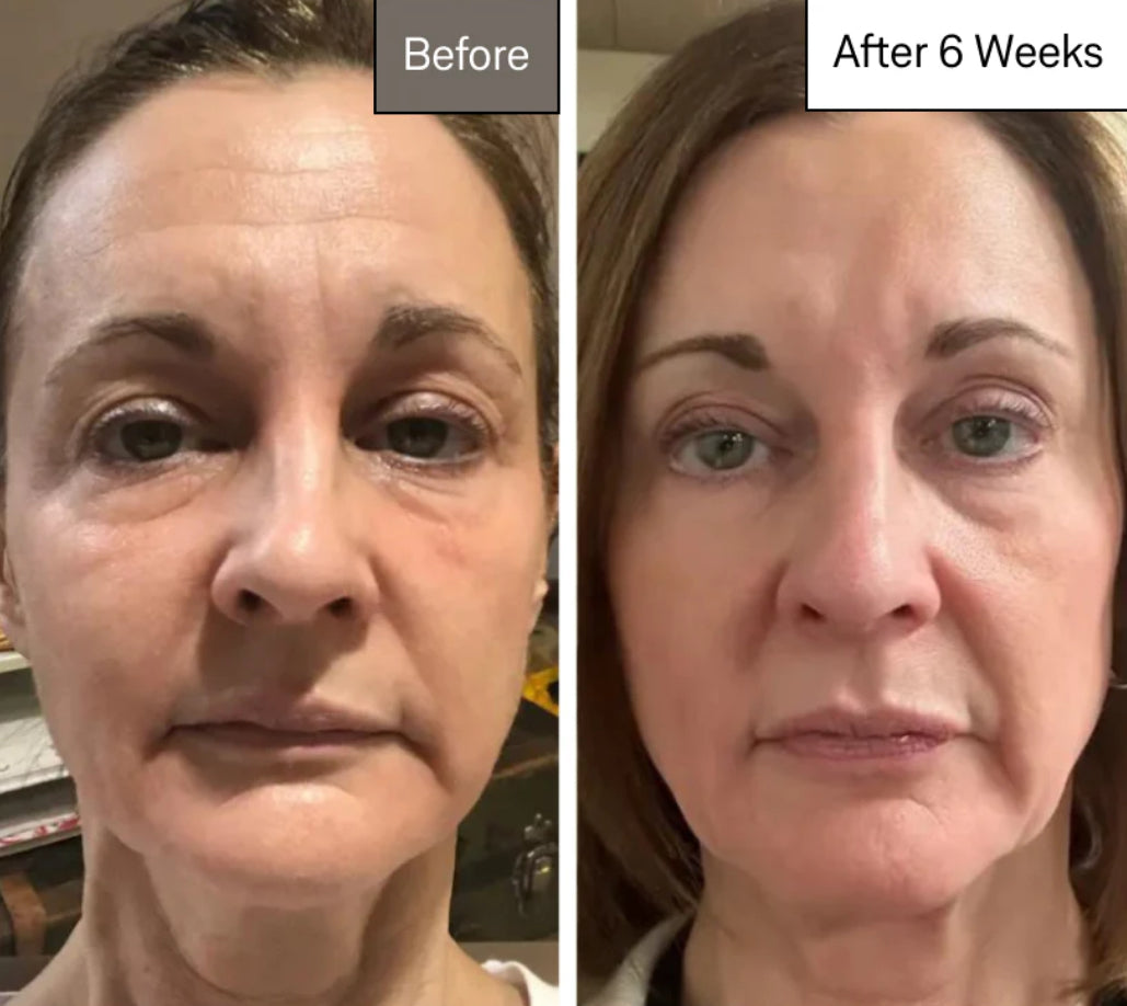 Omnilux Contour Face LED Mask