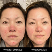 Omnilux Contour Face LED Mask